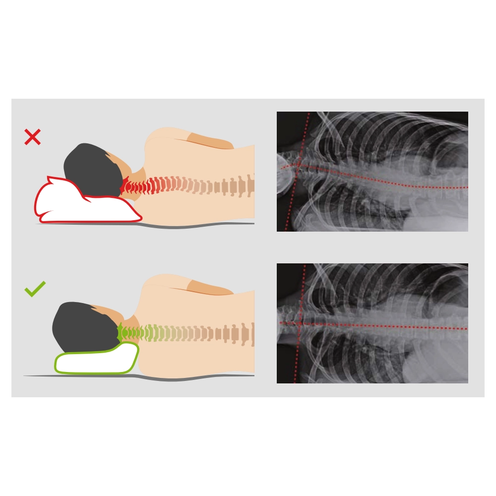 Sissel hoofdkussen Classic Plus - Orthopedisch hoofdkussen - Afbeelding 4